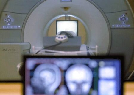 بهره‌برداری از پیشرفته‌ترین دستگاه MRI در زابل